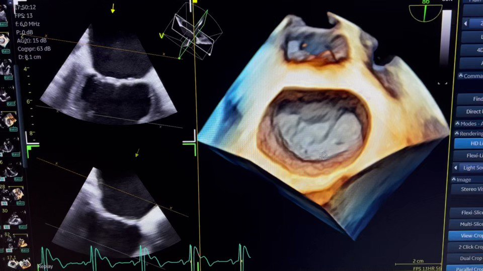Heart 3D (12fps)