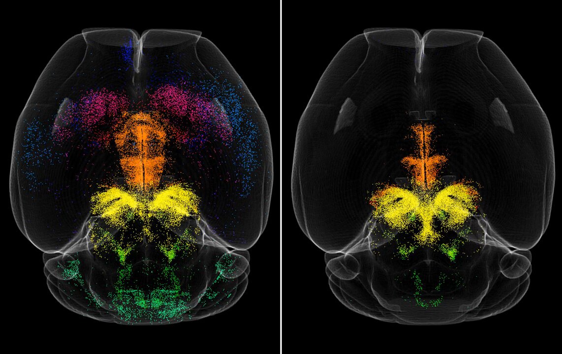 Negative Emotions Recruit the Parabrachial Nucleus Efferent to the VTA to Disengage Instrumental Food Seeking