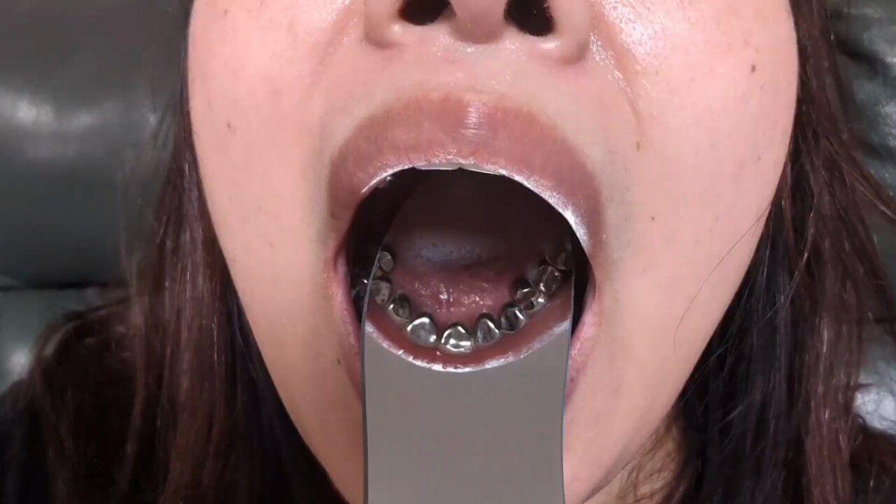 熟女銀歯画像  / X