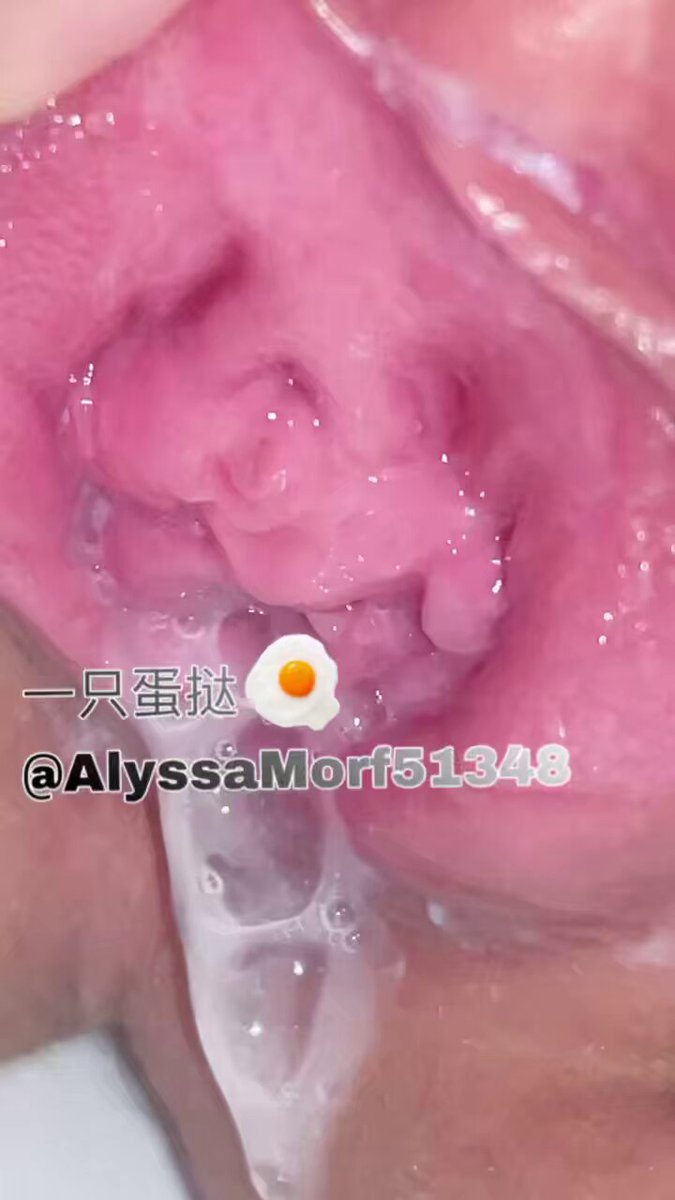 Twitter Image