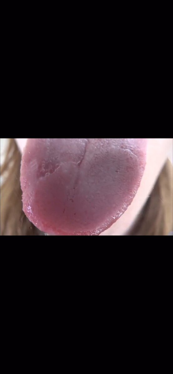 Twitter Image