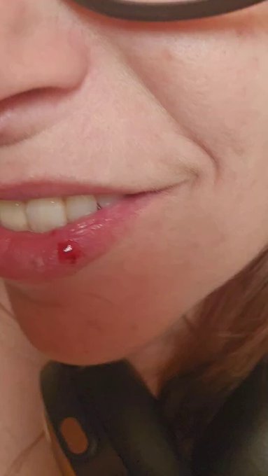 My dog clocked me in the face on accident and  this song just happened to pop on. .... artistic expressions<a href="/tag/realloyalfans"class="tags"><span>#realloyalfans</span></a>