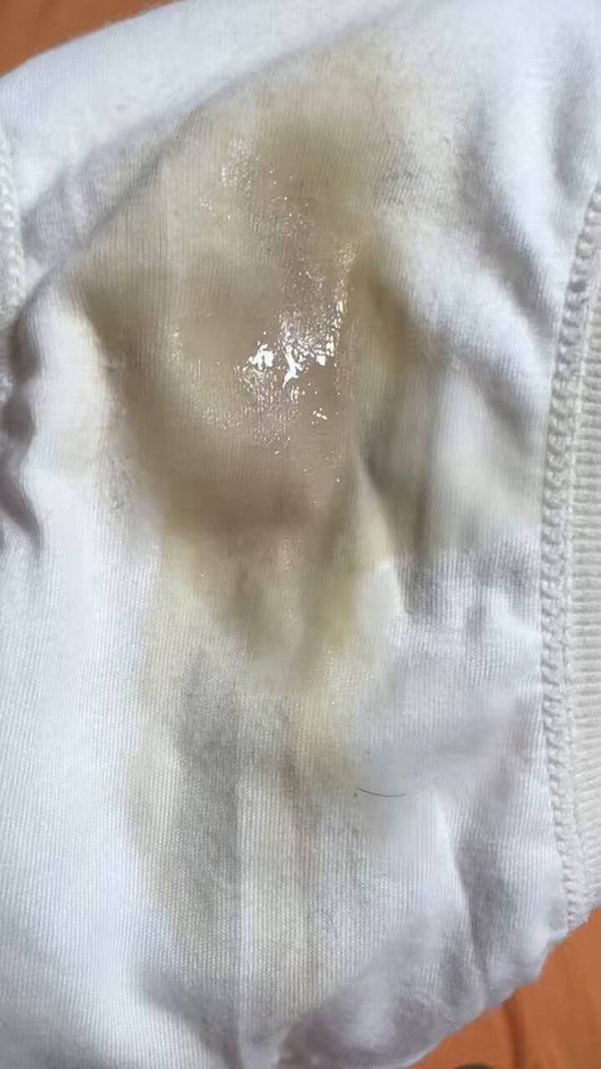 媒体预览