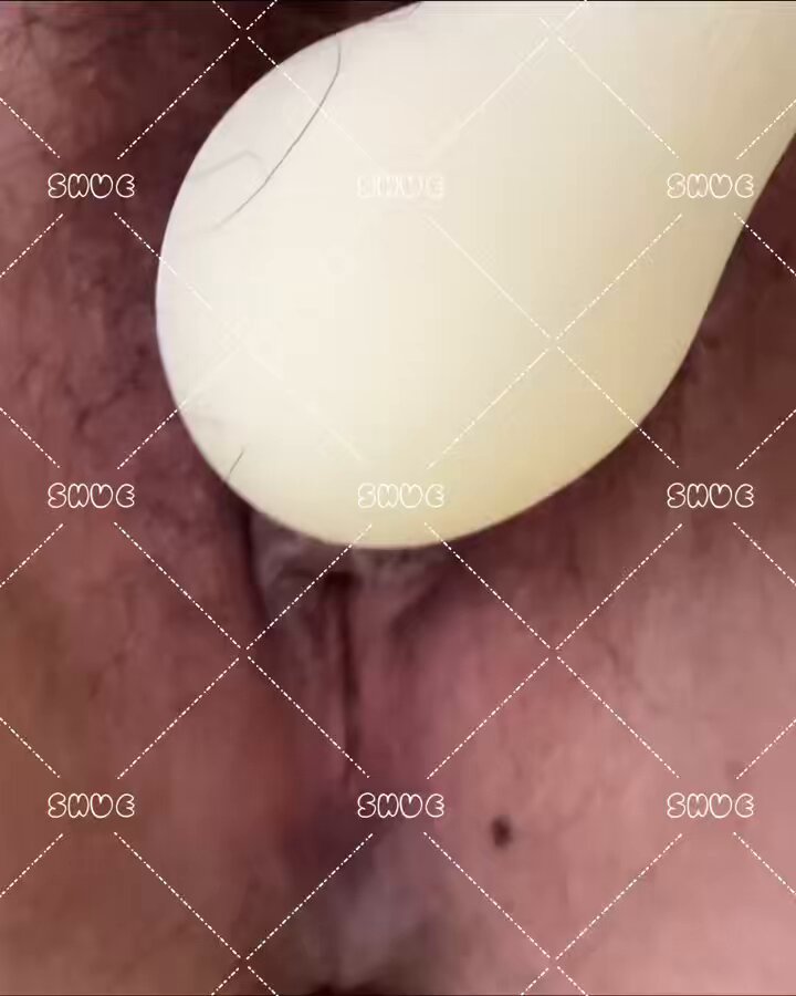 媒体预览
