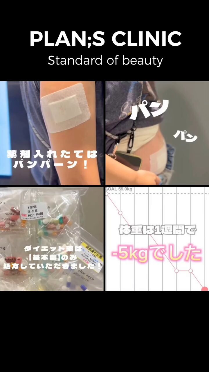 プランエス　脂肪 これであなたもお腹のぜい肉とサヨナラ~ | 韓国プランエスクリニック