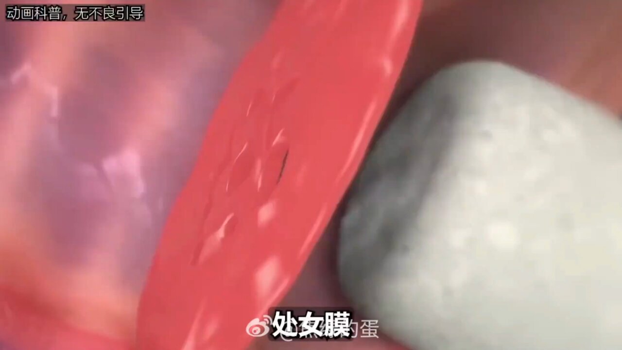 处女膜  / X