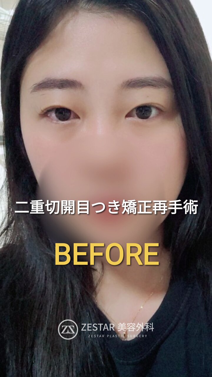 美容外科手術プラクティス 2 美容外科手術プラクティス 2