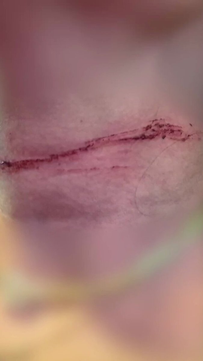 Vrouw aangevallen in de Parkstraat in Breda