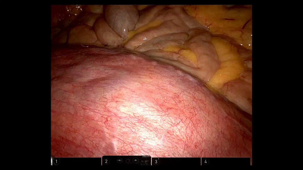 TeachMeSurgery (@teachmesurgery) / X