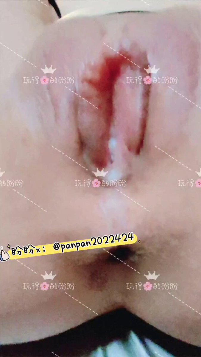 媒体预览