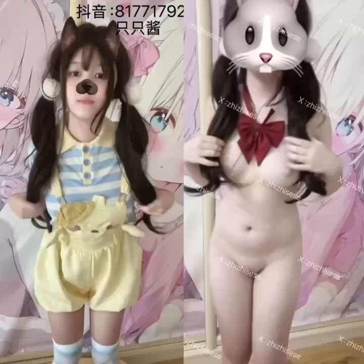 媒体预览