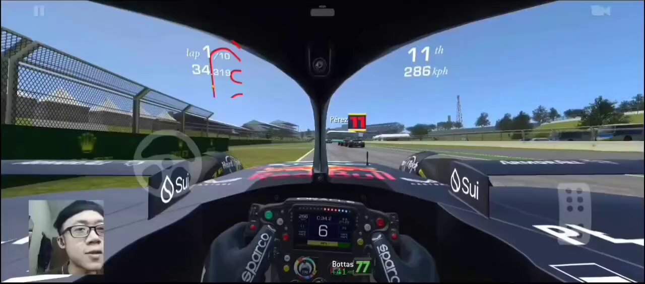 Жыныс мүшесінің контузиясы