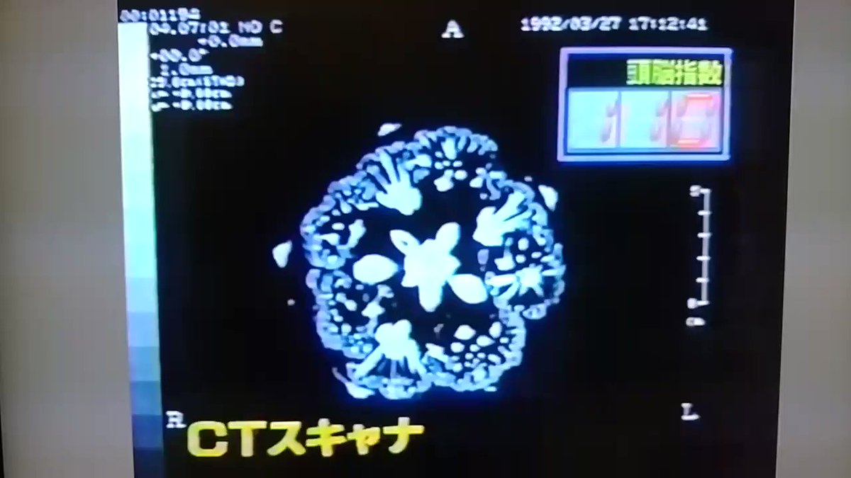 デいモん店長 今日は7月18日ですね あの伝説のカリフラワー事件のあったマジカル頭脳パワー の放送からついに四半世紀 25年が経ちました 今見返しても面白いですね デいモん店長 今日は7月18日ですね あの伝説のカリフラワー事件のあったマジカル頭脳パワー の放送からついに四半世紀 25年が経ちました 今見返しても面白いですね