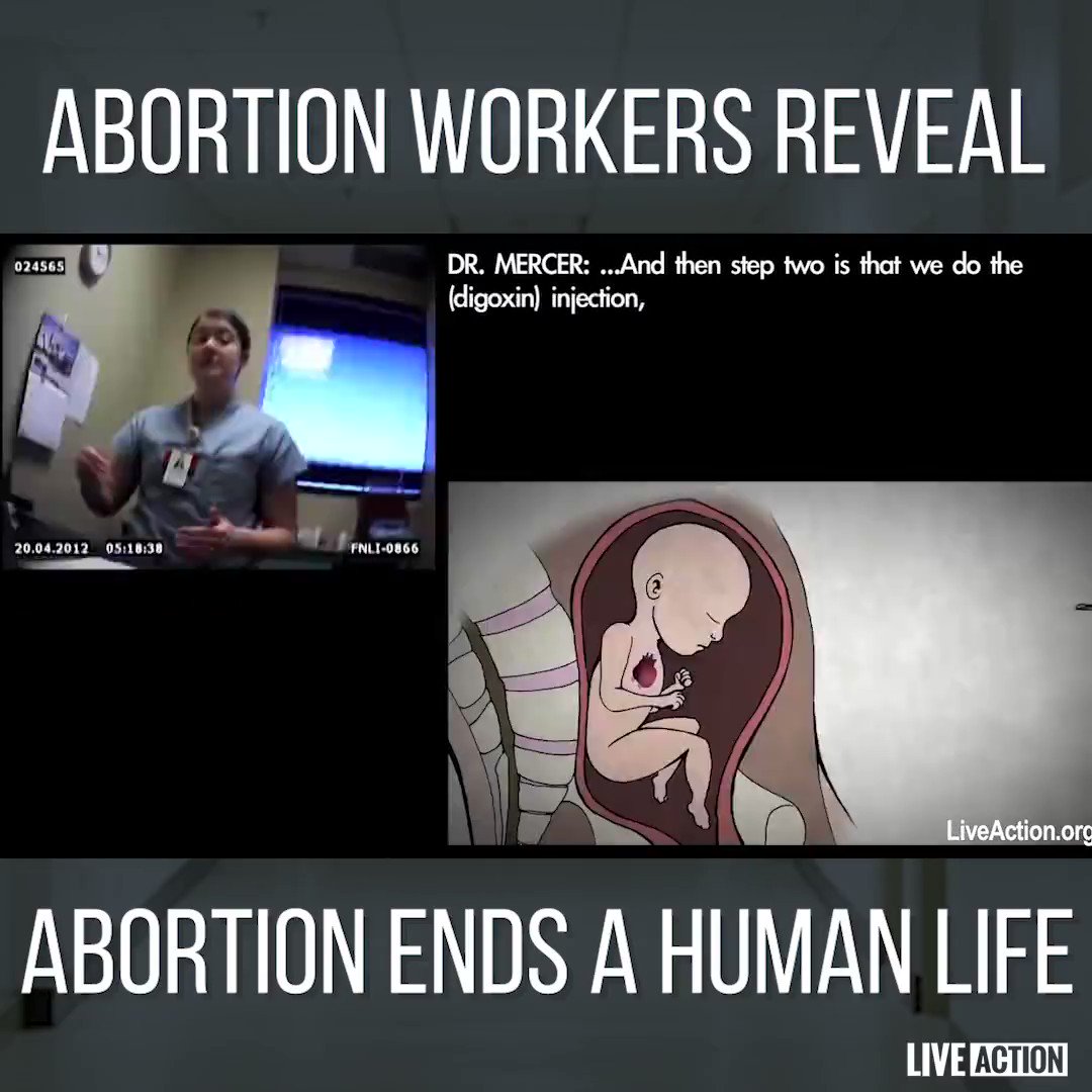 Inside abortion clinics, fully developed & often viable babies are killed through all 9 months of pregnancy. Cameras caught abortionists admitting that they remove babies "in pieces," even joking about procedures they commit #FIFAWWC #U20WWC #U17WWC #FIFA