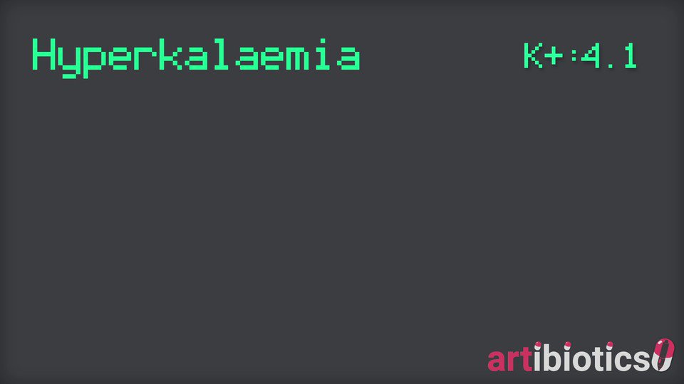 Hyperkalaemia #ECG changes animated. This is a life-saving opportunity if you can catch it! #FOAMed #EKG #Cardiology