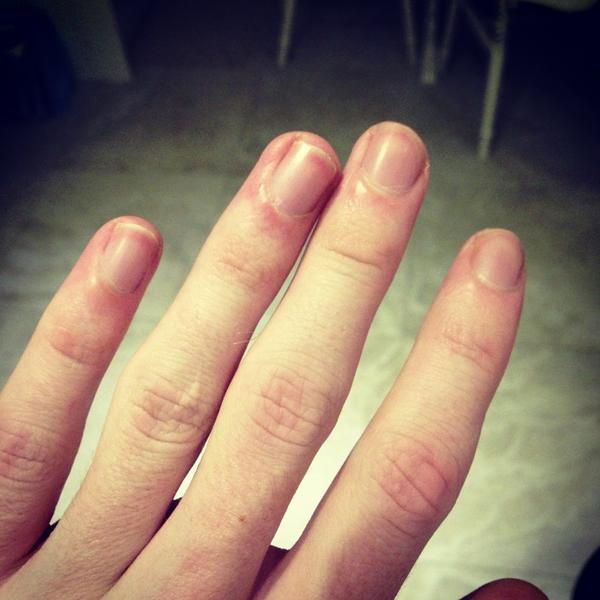 Whenever I cut my nails I feel so different towards cloth, like it creates  a bad feel? Why does this happen? - Quora