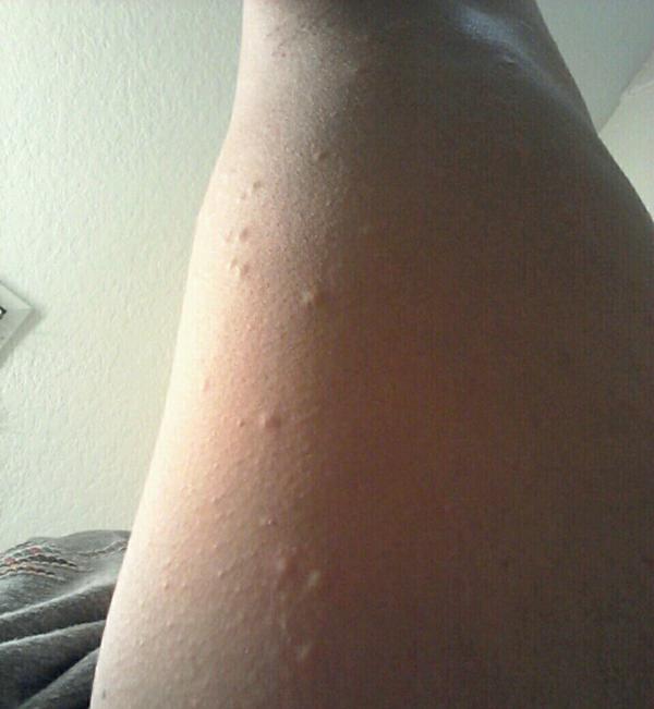 BiancaSultana's tweet image. #campingproblems :(