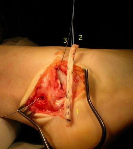 adrianevans11's tweet image. Something like this #ouch #supdoc