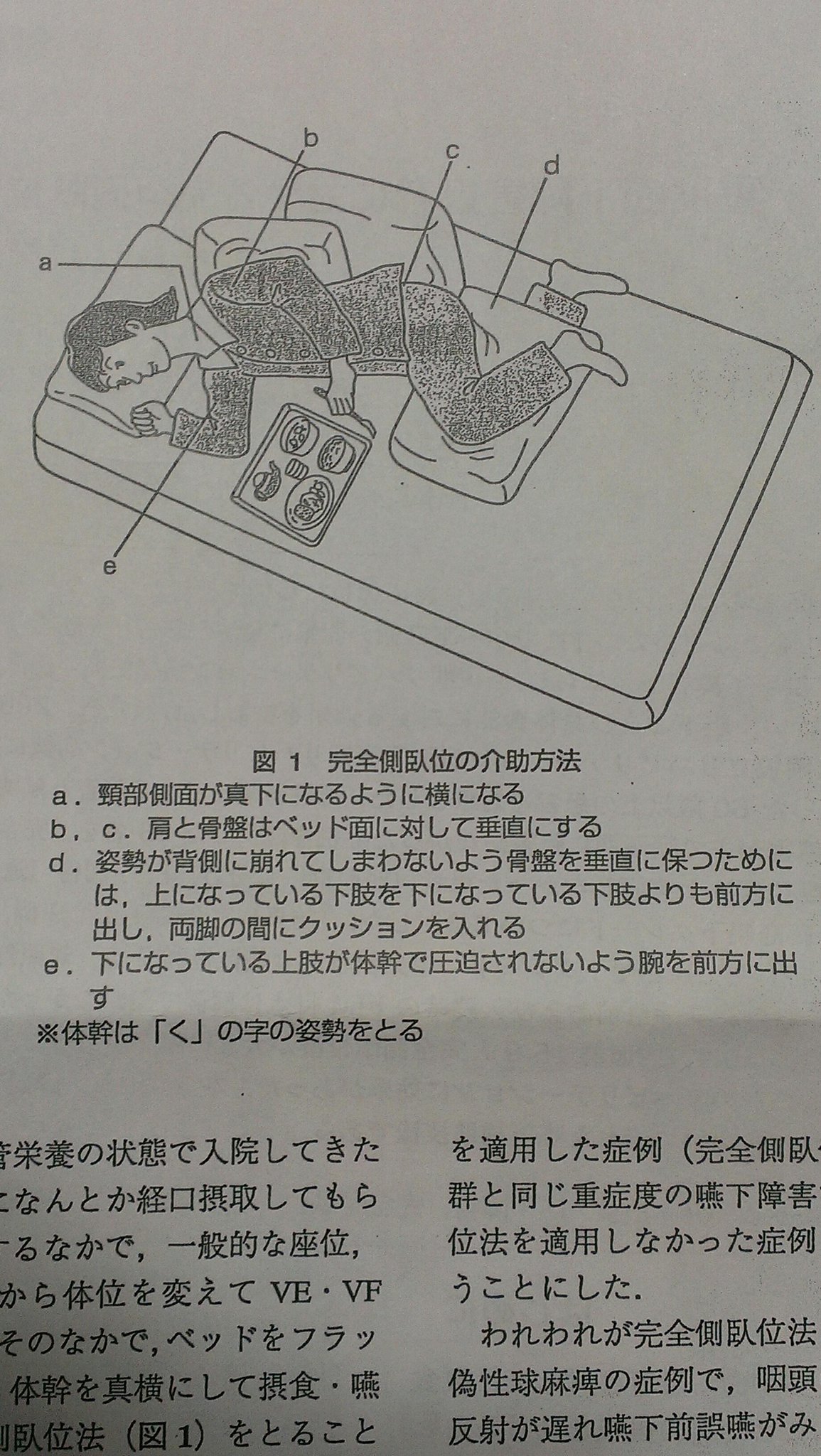 けめこ ナース V Twitter 嚥下障害時の摂食体位についての講演 フラットなベッドに完全側臥位 重力の作用で中 下咽頭の側壁に食塊が貯留し 誤嚥が減るというもの 私達が今までしてきたファーラー位 小さい嚥下スプーンによる食事介助は 何だったのか 今後st と けめこ ナース V Twitter 嚥下障害時の摂食体位についての講演 フラットなベッドに完全側臥位 重力の作用で中 下咽頭の側壁に食塊が貯留し 誤嚥が減るというもの 私達が今までしてきたファーラー位 小さい嚥下スプーンによる食事介助は 何だったのか 今後st と