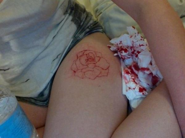 AnasFailure's tweet photo. Since everyone was fascinated by the snowflake cuts, what about rose cuts? #selfharmprobz http://t.co/cfpq8a1U