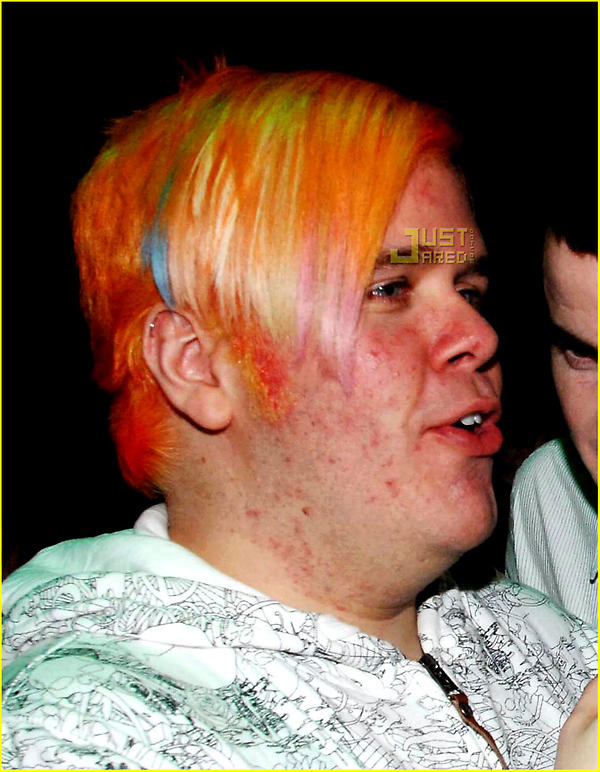 Ohdirectionarmy's tweet photo. @PerezHilton I honestly don't know why you are EVEN TALKING ABOUT Zayn .. remember when you use to look like this? http://t.co/MROhKbEZ