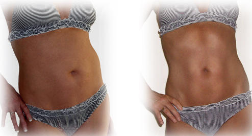 UVbodysculpture's tweet photo. @AlyssaLouWho You can have that cute toned body so much easier than you ever thought. http://t.co/C3Vfzbns http://t.co/Yie8RvDd