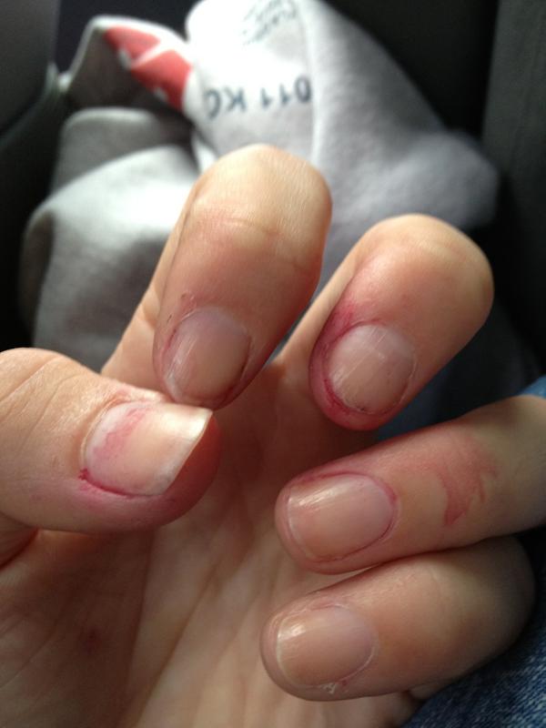 kenzzieeann's tweet image. Both hands are pink. #raspberrypicking 😒