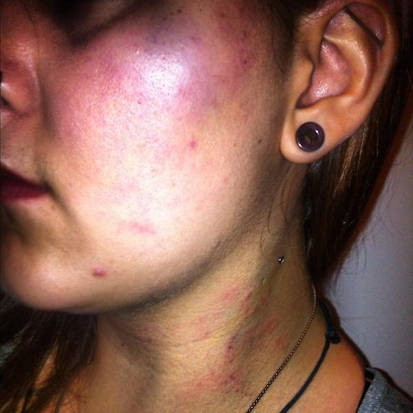 damnsellouts's tweet photo. Stupid straight guys at the gay bar during pride ... Who chokes a girl http://t.co/8FgbfYXg
