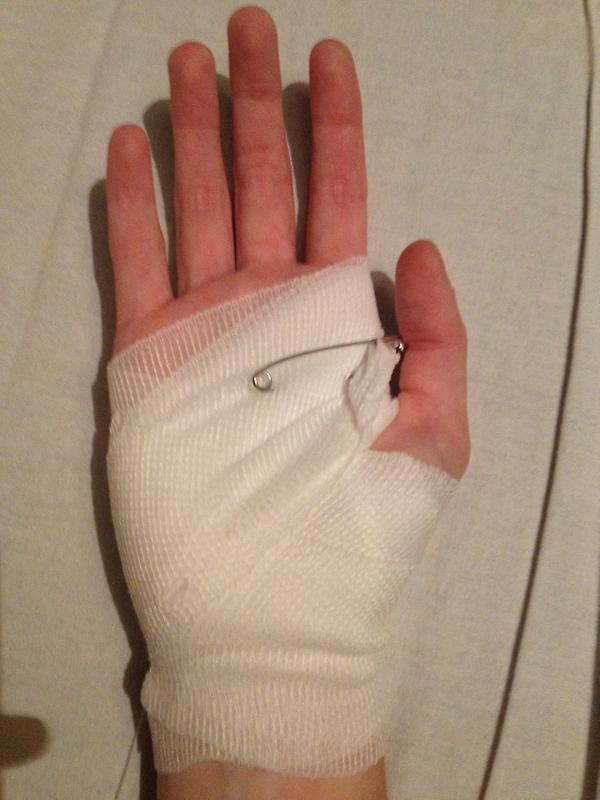 Stephannieex On Twitter En Dan Verbrand Je Je Hand Aan Een Stijltang Door Chelan Vellen Hangen Los Aaaaaaauuuuwwww Http T Co G3qdipwr