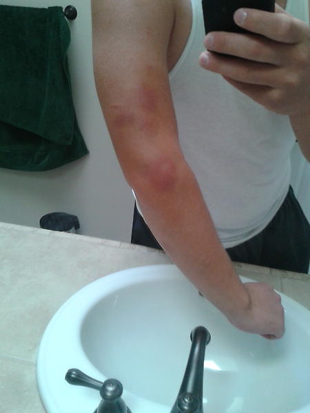 ThaPandaMann007's tweet image. The day after a football game&amp;lt;&amp;lt;&amp;lt;&amp;lt; #SoreEverywhere #BruisesOnBruises