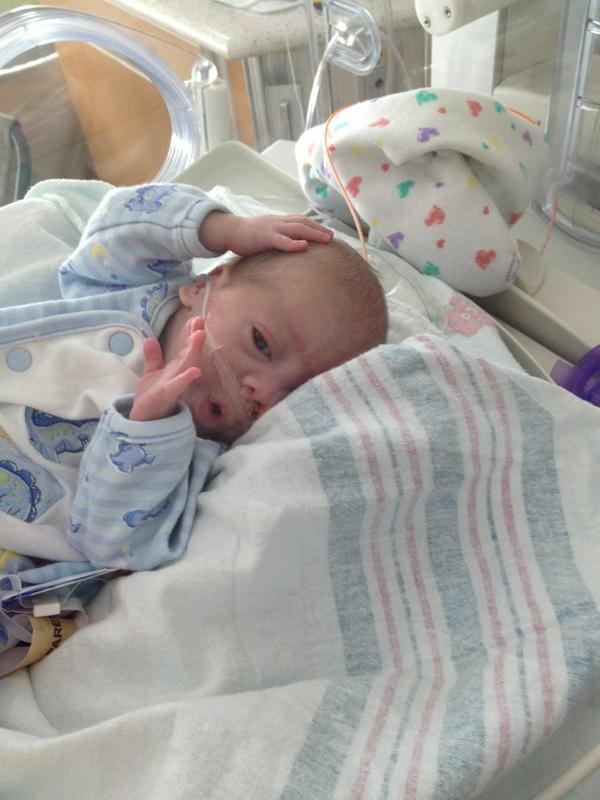 tictacsally's tweet photo. Patrick before kangaroo care ... http://t.co/B1IKil5H