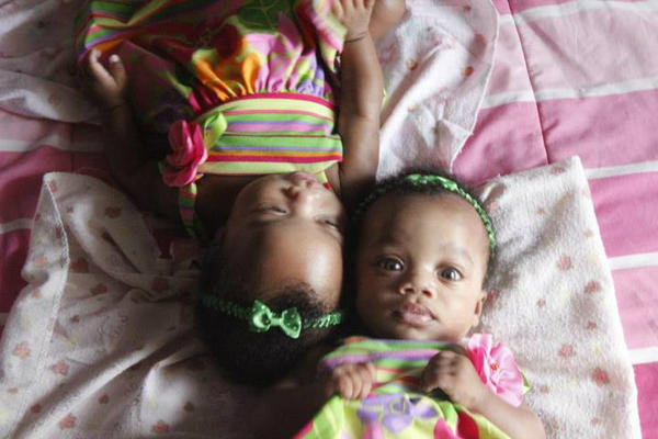 ManEatinNaNa's tweet photo. Look at my twins http://t.co/v4NpFOjT