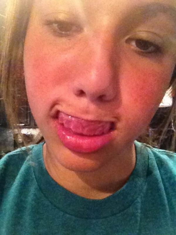 EmileeTagseth's tweet image. #EmbarrassYourBestFriend @ashleyhrudka  "where did your teeth go?!" #toothlesswonder