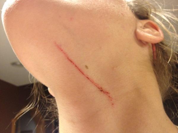 MRetting10's tweet image. looks like someone knived me #thanksmahtomedi #uncalledfor