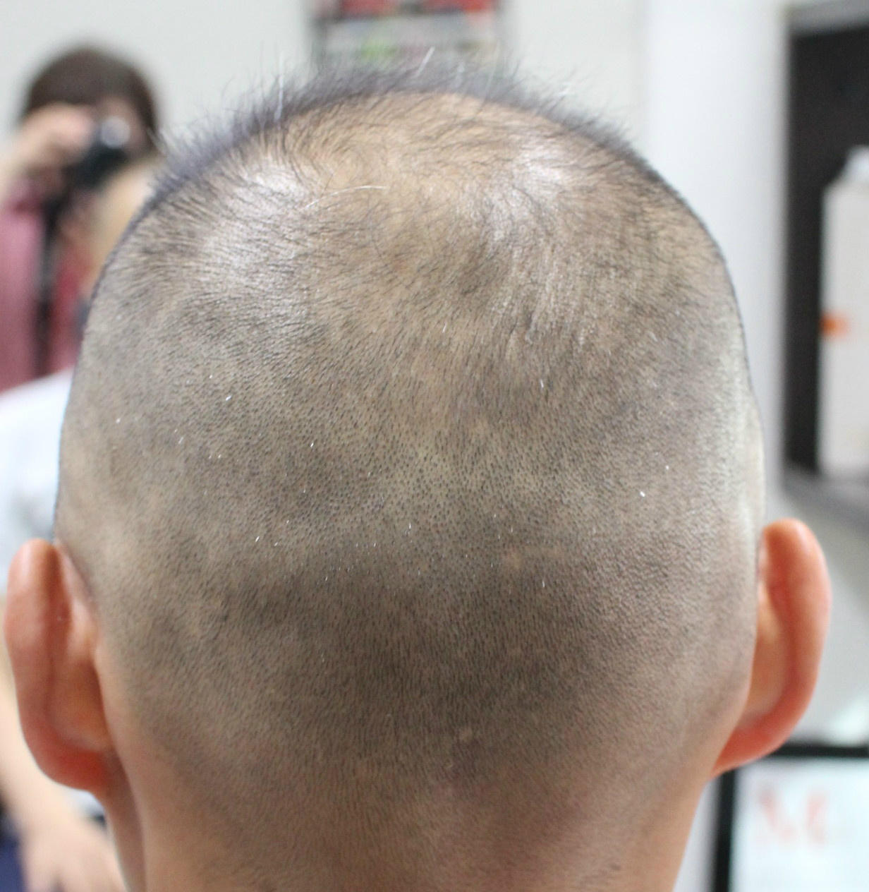 髪切屋taku 大阪府守口市のヘアサロン 髪切屋taku です 薄毛でお悩みの貴方 坊主頭にしませんか 日本一短い０ ４mmのバリカンでカットすると髪が多く見えるかも Http T Co Smc8hijc Http T Co W1zkp8ep Twitter