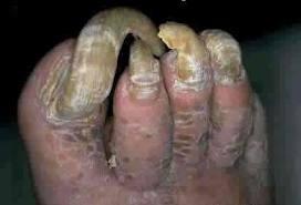 MLaccoheexo's tweet photo. #ToeAFannyTuesday @TheRoyCropper a toe like this?!?! http://t.co/5pMF4Umc