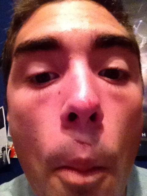 ninjakillafox's tweet image. See that red hitter stash? #Frisbeetotheface #faceproblems