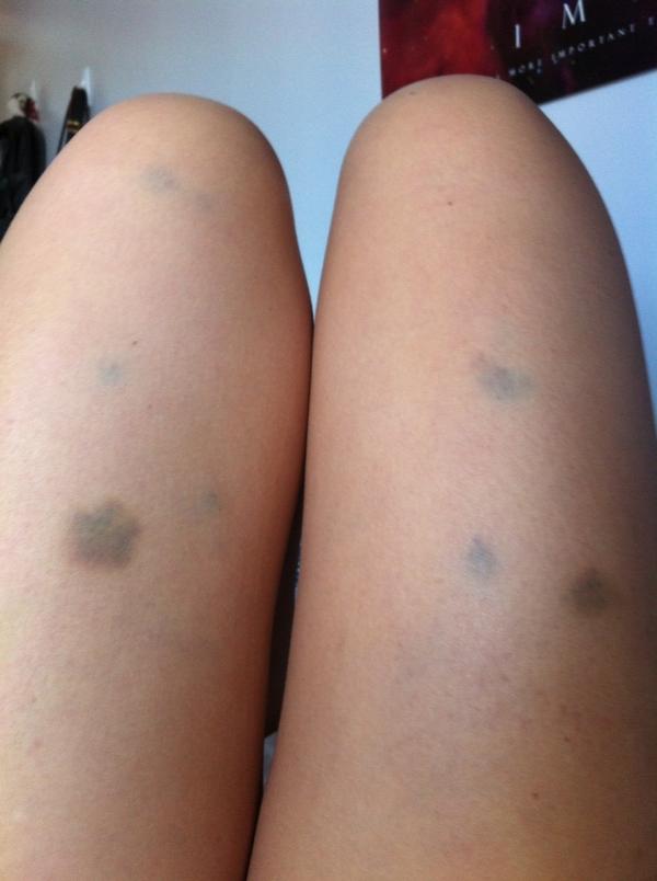 feedrosalee's tweet image. This shits rough #poloproblems