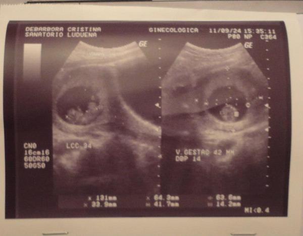 cris_debarbora's tweet photo. @kari_prince MIRA PRINCE ESTA CRECIENDO MI PRIMER BEBE..TODAVIA NO SE EL SEXO PERO LO MAS IMPORTANTE Q NAZCA SANITO/A. http://t.co/JRgnH7vT