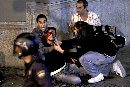 Tremenda imagen de un manifestante herido en Neptuno, y la cara de terror de su amigo. vía @StarmanCB