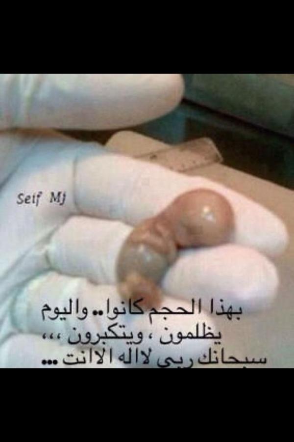 99Amaly's tweet photo. حجم الجنين في اول شهور الحمل سبحان الله http://t.co/JIuoVym3