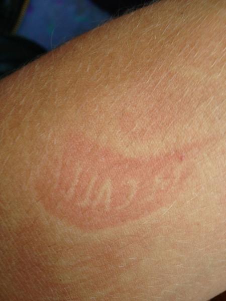 itssamcallahan's tweet photo. Fell asleep and my #callaband printed into my arm! Lol http://t.co/kV6IcGE1