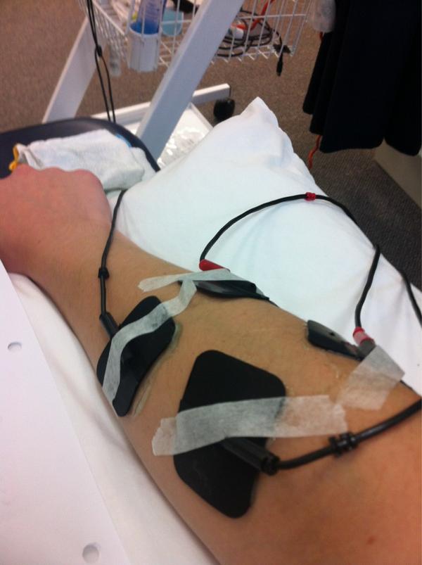 ETERNALT0AST's tweet image. Oh and this!! #interferential #electrotherapy