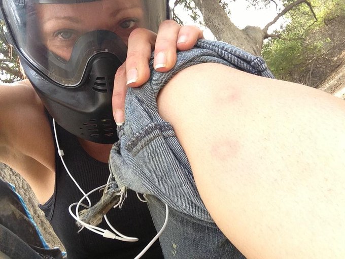 Either I got into a fight a an octopus or I'm dead... http://t.co/3LVQMBAa<a href="/tag/sdcc2014"class="tags"><span>#sdcc2014</span></a>