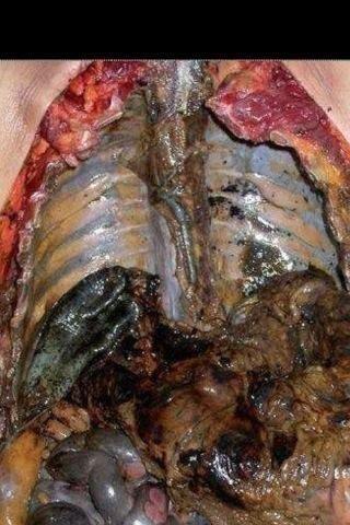 صوره عجيبه لجسم مدخن الداخل