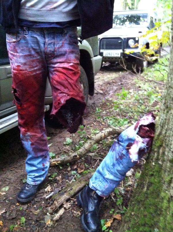 EricFeijten's tweet image. #remotetrauma pijn in mn voet #schokkend #nietecht