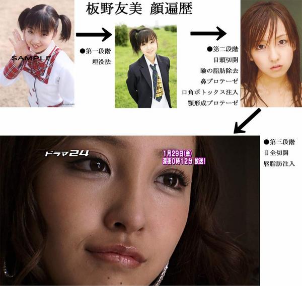 板野友美の整形 豊胸疑惑を検証する画像まとめ アゴが折れて顔面崩壊も ガラパゴス速報 板野友美の整形 豊胸疑惑を検証する画像まとめ アゴが折れて顔面崩壊も ガラパゴス速報