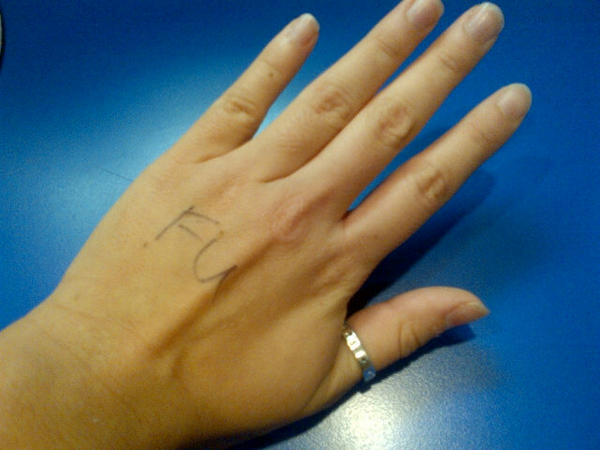 CarlottaMclean's tweet image. What the resident wrote on my hand #FU #shelovesme #deepdowninside