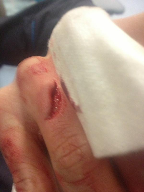 FrankieStennett's tweet photo. When you have to be off work because you cut your finger #handy #wanker http://t.co/X9aQLX7D