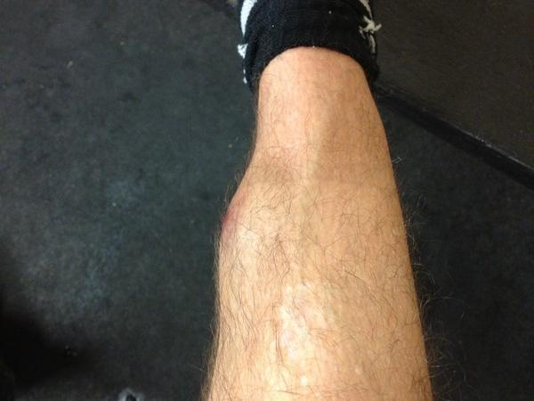 CharrosHockey's tweet image. Nobody said a W didn't come without a little blood &amp;amp; sweat ... No tears though #MikeMac #toughguyaward